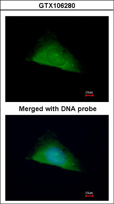 Immunofluorescence of paraformaldehyde-fixed HeLa using TRIM37 antibody at 1:200 dilution.