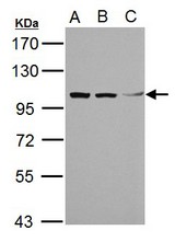Sample (30 ug of whole cell lysate). A: A431, B: HeLa, C: HepG2. 7.5% SDS PAGE. TRIM37 / TEF3 antibody diluted at 1:1000.