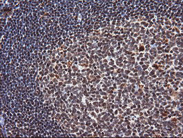 IHC of paraffin-embedded Human tonsil using anti-TRIM38 mouse monoclonal antibody.