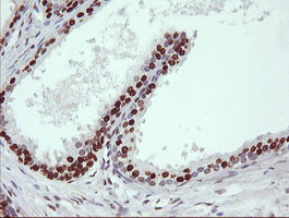 IHC of paraffin-embedded Human prostate tissue using anti-TRIM38 mouse monoclonal antibody.
