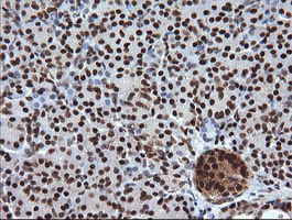 IHC of paraffin-embedded Human pancreas tissue using anti-TRIM38 mouse monoclonal antibody.