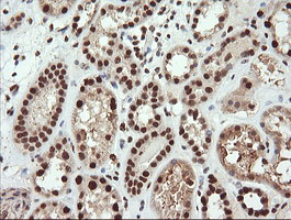 IHC of paraffin-embedded Human Kidney tissue using anti-TRIM38 mouse monoclonal antibody.