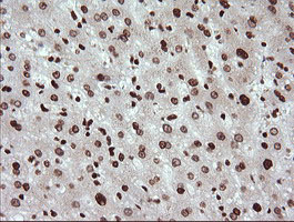 IHC of paraffin-embedded Human liver tissue using anti-TRIM38 mouse monoclonal antibody.