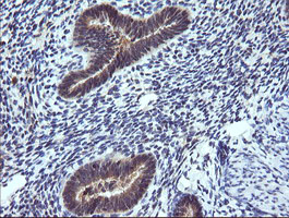 IHC of paraffin-embedded Human endometrium tissue using anti-TRIM38 mouse monoclonal antibody.
