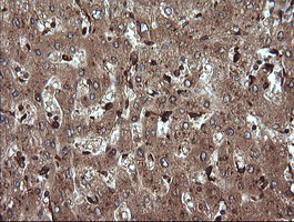 IHC of paraffin-embedded Human liver tissue using anti-TRIM38 mouse monoclonal antibody.