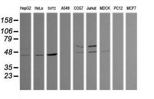 Western blot of extracts (35 ug) from 9 different cell lines by using anti-TRIM38 monoclonal antibody (HepG2: human; HeLa: human; SVT2: mouse; A549: human; COS7: monkey; Jurkat: human; MDCK: canine; PC12: rat; MCF7: human).