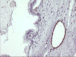 IHC of paraffin-embedded Human prostate tissue using anti-TRIM38 mouse monoclonal antibody.