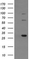 Negative control HEK293T lysate (Left lane) or HEK293T lysate containing recombinant protein fragment for human TRIM38 (NP_006346) gene (amino acids 1-265) (Right lane). Equivalent amounts (5 ug per lane) were separated by SDS-PAGE and then immunoblotted with anti-TRIM38. .