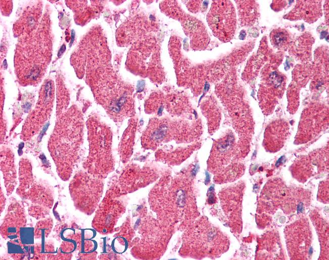 Anti-TRIM38 antibody IHC of human heart. Immunohistochemistry of formalin-fixed, paraffin-embedded tissue after heat-induced antigen retrieval. Antibody LS-B1108 concentration 5 ug/ml.