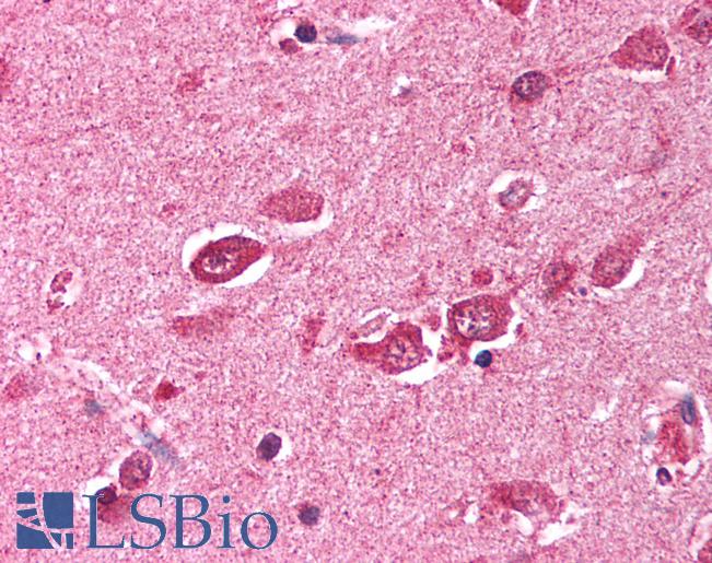 Anti-TRIM38 antibody IHC of human brain, cortex. Immunohistochemistry of formalin-fixed, paraffin-embedded tissue after heat-induced antigen retrieval. Antibody LS-B1108 concentration 5 ug/ml.