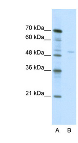 TRIM38 antibody LS-B1108 Western blot of Jurkat lysate.
