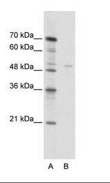 A: Marker, B: Jurkat Cell Lysate