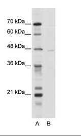 A: Marker, B: HepG2 Cell Lysate