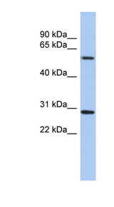 TRIM38 antibody LS-C109969 Western blot of ACHN lysate.