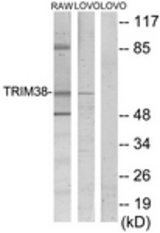 Western blot of extracts from LOVO/RAW264.7 cells, using TRIM38 Antibody. The lane on the right is treated with the synthesized peptide.