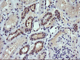IHC of paraffin-embedded Human Kidney tissue using anti-TRIM38 mouse monoclonal antibody.