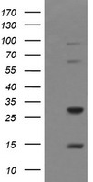 Negative control HEK293T lysate (Left lane) or HEK293T lysate containing recombinant protein fragment for human TRIM38 (NP_006346) gene (amino acids 1-265) (Right lane). Equivalent amounts (5 ug per lane) were separated by SDS-PAGE and then immunoblotted with anti-TRIM38. .