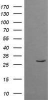 Negative control HEK293T lysate (Left lane) or HEK293T lysate containing recombinant protein fragment for human TRIM38 (NP_006346) gene (amino acids 1-265) (Right lane). Equivalent amounts (5 ug per lane) were separated by SDS-PAGE and then immunoblotted with anti-TRIM38. .