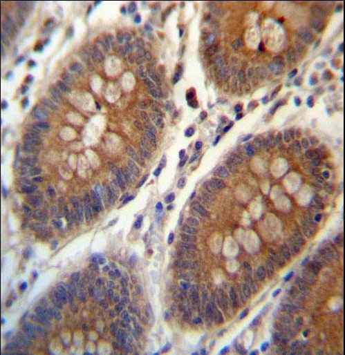 TRIM38 Antibody immunohistochemistry of formalin-fixed and paraffin-embedded human colon tissue followed by peroxidase-conjugated secondary antibody and DAB staining.