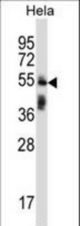 TRIM38 Antibody western blot of HeLa cell line lysates (35 ug/lane). The TRIM38 antibody detected the TRIM38 protein (arrow).