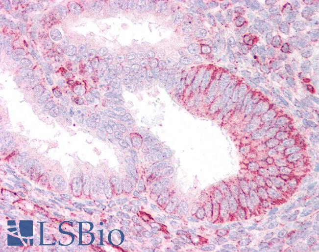 Anti-TRIM39 / RNF23 antibody IHC of human uterus. Immunohistochemistry of formalin-fixed, paraffin-embedded tissue after heat-induced antigen retrieval. Antibody LS-B7333 concentration 3.75 ug/ml.