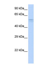 TRIM39 / RNF23 antibody LS-C109964 Western blot of Fetal liver lysate.