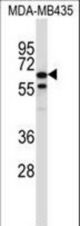 TRIM39 Antibody western blot of MDA-MB435 cell line lysates (35 ug/lane). The TRIM39 antibody detected the TRIM39 protein (arrow).