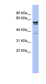 TRIM4 / RNF87 antibody LS-C109981 Western blot of Fetal Stomach lysate.