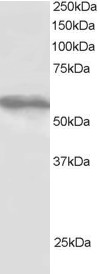 Antibody staining (1 ug/ml) of HepG2 lysate (RIPA buffer, 30 ug total protein per lane). Primary incubated for 1 hour. Detected by Western blot of chemiluminescence.
