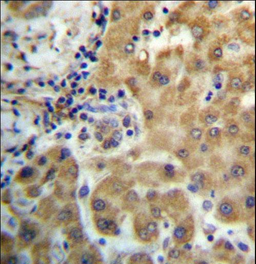 TRIM4 Antibody immunohistochemistry of formalin-fixed and paraffin-embedded human liver tissue followed by peroxidase-conjugated secondary antibody and DAB staining.