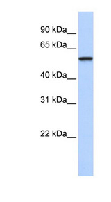 TRIM4 / RNF87 antibody LS-C101668 Western blot of Fetal Brain lysate.