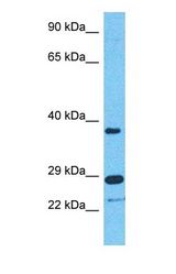 Western blot of TRI40 Antibody with human Jurkat Whole Cell lysate.