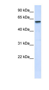 TRIM41 antibody LS-C101524 Western blot of Placenta lysate.