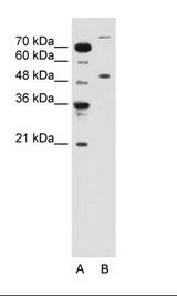 A: Marker, B: Jurkat Cell Lysate