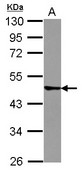 Sample (30 ug of whole cell lysate) A: A431 10% SDS PAGE TRIM43 antibody diluted at 1:1000