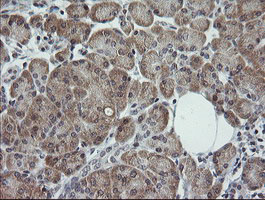 IHC of paraffin-embedded Human pancreas tissue using anti-TRIM44 mouse monoclonal antibody.