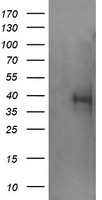 HEK293T cells were transfected with the pCMV6-ENTRY control (Left lane) or pCMV6-ENTRY TRIM44 (Right lane) cDNA for 48 hrs and lysed. Equivalent amounts of cell lysates (5 ug per lane) were separated by SDS-PAGE and immunoblotted with anti-TRIM44.