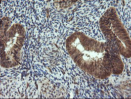 IHC of paraffin-embedded Human endometrium tissue using anti-TRIM44 mouse monoclonal antibody.