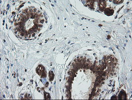 IHC of paraffin-embedded Human breast tissue using anti-TRIM44 mouse monoclonal antibody.