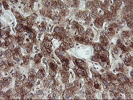 IHC of paraffin-embedded Human liver tissue using anti-TRIM44 mouse monoclonal antibody.