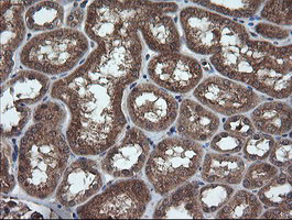 IHC of paraffin-embedded Human Kidney tissue using anti-TRIM44 mouse monoclonal antibody.