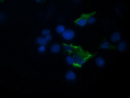 Anti-TRIM44 mouse monoclonal antibody immunofluorescent staining of COS7 cells transiently transfected by pCMV6-ENTRY TRIM44.