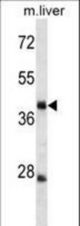 TRIM44 Antibody western blot of mouse liver tissue lysates (35 ug/lane). The TRIM44 Antibody detected the TRIM44 protein (arrow).