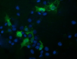 Anti-TRIM44 mouse monoclonal antibody immunofluorescent staining of COS7 cells transiently transfected by pCMV6-ENTRY TRIM44.