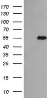 HEK293T cells were transfected with the pCMV6-ENTRY control (Left lane) or pCMV6-ENTRY TRIM44 (Right lane) cDNA for 48 hrs and lysed. Equivalent amounts of cell lysates (5 ug per lane) were separated by SDS-PAGE and immunoblotted with anti-TRIM44.