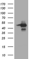 HEK293T cells were transfected with the pCMV6-ENTRY control (Left lane) or pCMV6-ENTRY TRIM44 (Right lane) cDNA for 48 hrs and lysed. Equivalent amounts of cell lysates (5 ug per lane) were separated by SDS-PAGE and immunoblotted with anti-TRIM44.