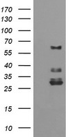 E.coli lysate (5 ug, left lane) and E.coli lysate expressing human recombinant protein fragment (5 ug, right lane) corresponding to amino acids 288-580 of human TRIM45(NP_079464) were separated by SDS-PAGE and immunoblotted with anti-TRIM45.