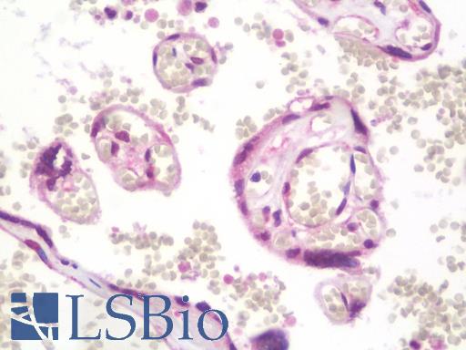Anti-TRIM45 antibody IHC staining of human placenta. Immunohistochemistry of formalin-fixed, paraffin-embedded tissue after heat-induced antigen retrieval. Antibody LS-B9825 concentration 10 ug/ml.