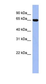 TRIM47 antibody LS-C109948 Western blot of THP-1 cell lysate.