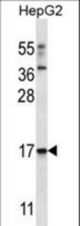TRIM48 Antibody western blot of HepG2 cell line lysates (35 ug/lane). The TRIM48 antibody detected the TRIM48 protein (arrow).